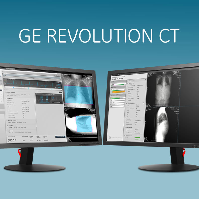 GE Revolution CT